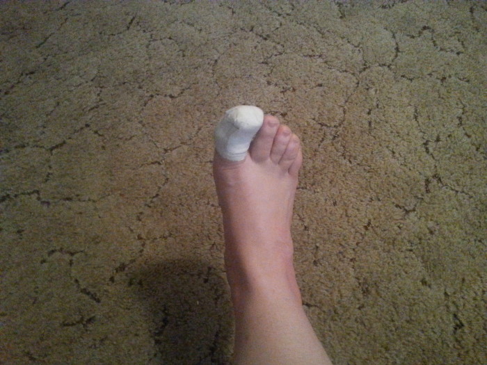 Toe jam