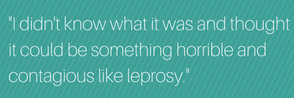 I didn't know what it was and thought it could be something horrible and contagious like leprosy.