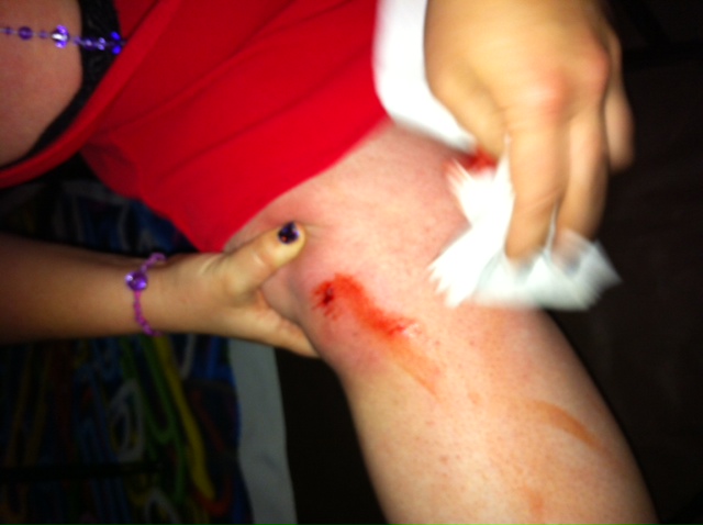 Thanks to Jana, this moment was not completely lost. I only wish I had waited to wipe the blood that was dripping down to my ankle...
